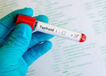 Typhoid