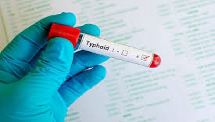 Typhoid